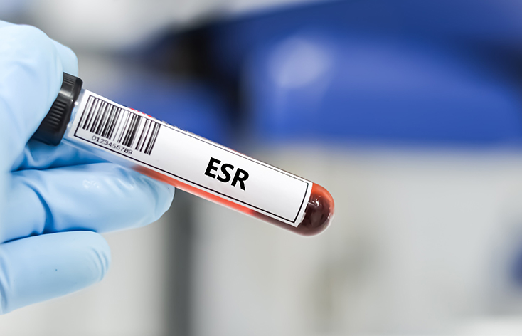 ESR Test in Ludhiana